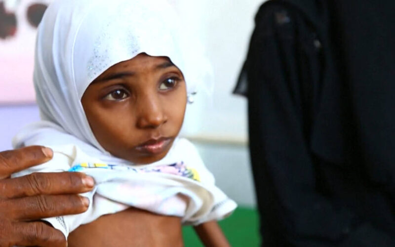 La ONU declara hambruna en Yemen al tiempo que las partes en conflicto se reúnen en Suecia