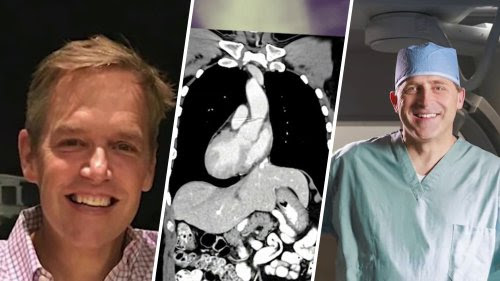 Cirujano de Washington D. C. se hace cargo del caso de un hombre que nació con el corazón al lado derecho